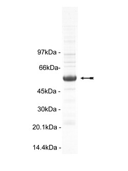 Eurofins DiscoverX CaM Kinase IV Protein, Active 10 &mu;g | Buy Online | Eurofins DiscoverX | Fisher Scientific